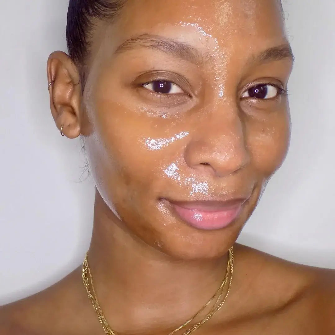 Mānuka Honey & Acne: Do The Benefits Live Up To The Buzz?